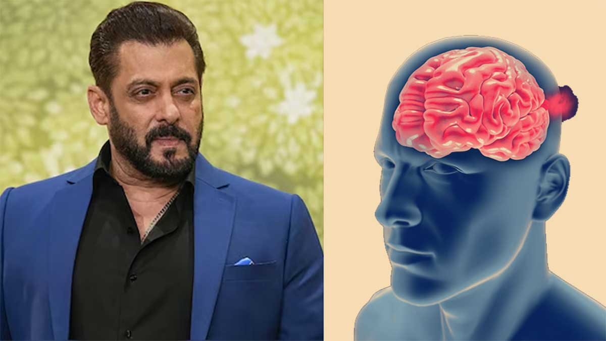 Brain Aneurysm जिससे जूझ रहे हैं बॉलीवुड एक्‍टर Salman Khan, जानें इस गंभीर बीमारी के लक्षण और खतरे
