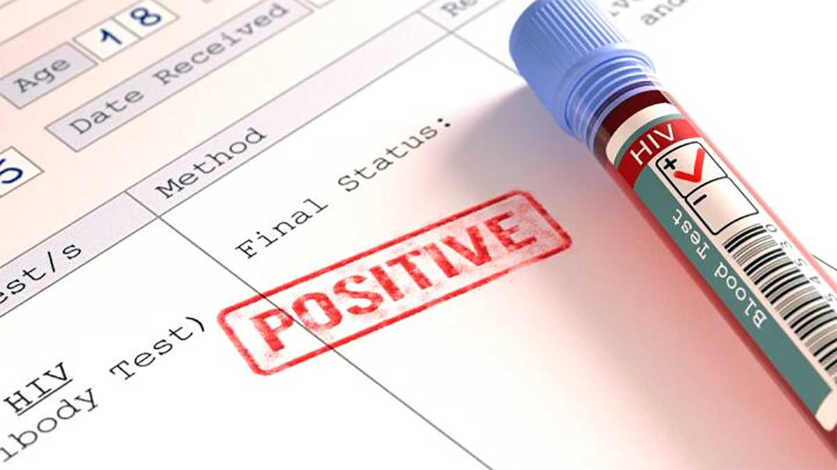 पंजाब में गहराया HIV का संकट, डरा रहे हैं नए आंकड़े, सामने आई संक्रमण फैलने की यह बड़ी वजह