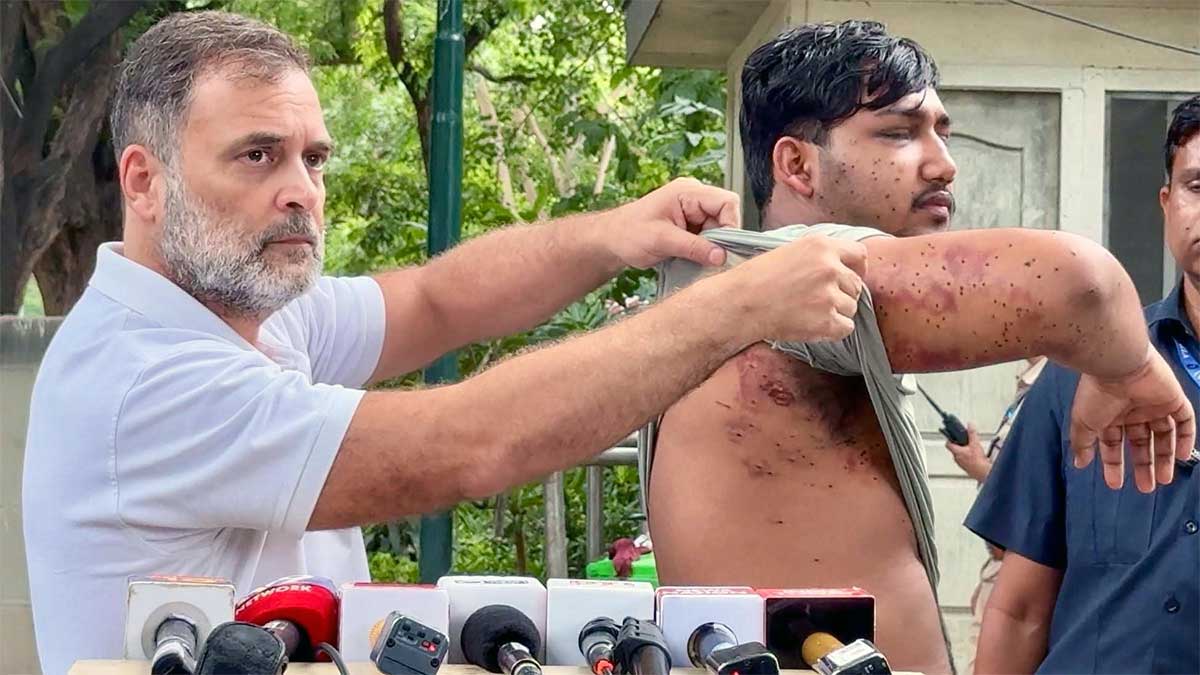 पैलेट गन पीड़ित छात्र के साथ राहुल गांधी की PC, शिक्षा मंत्री धर्मेंद्र प्रधान के इस्तीफे की दोहराई मांग