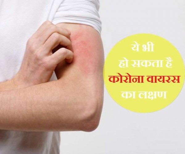 क्या अब त्वचा पर चकत्ते भी हैं कोरोना वायरस का लक्षण?