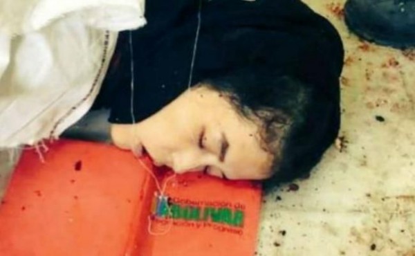 काबुल यूनिवर्सिटी पर आतंकी हमला, 19 स्टूडेंट्स की मौत, दो दर्जन से अधिक जख्मी